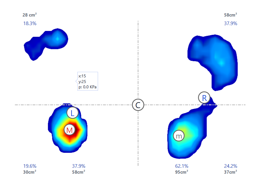 imagen estudio de la pisada