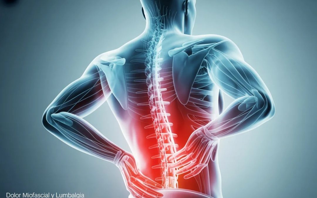 Dolor Miofascial y Lumbalgia