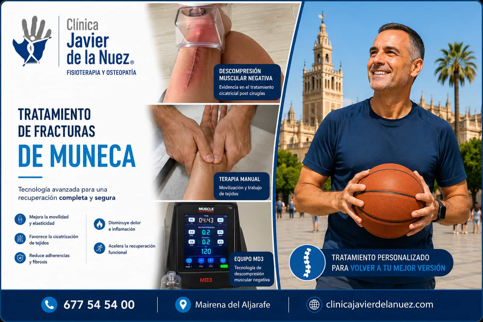 Tratamiento de fracturas de muñeca en Clínica Javier de la Nuez, Mairena del Aljarafe (Sevilla)