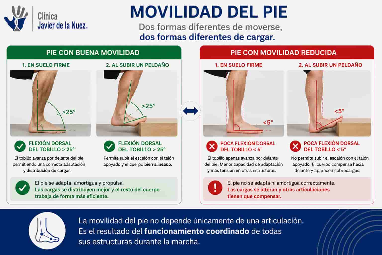 Comparativa de movilidad del pie: flexion dorsal de tobillo normal frente a movilidad reducida y sus compensaciones biomecanicas, Clinica Javier de la Nuez